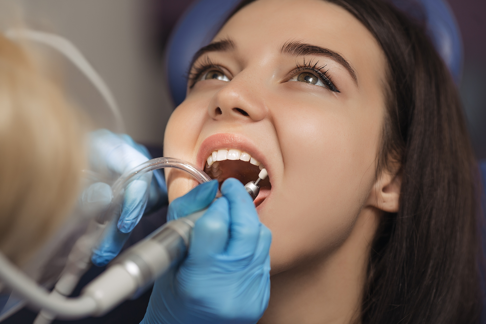Essential Aftercare Tips for a Smooth Tooth Extraction Recovery