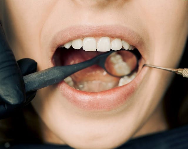From Healing to Success: The Importance of Post-Operative Care for Implants 